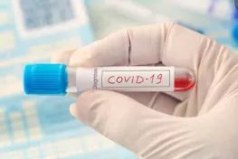 Covid-19 test